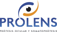 Prolens