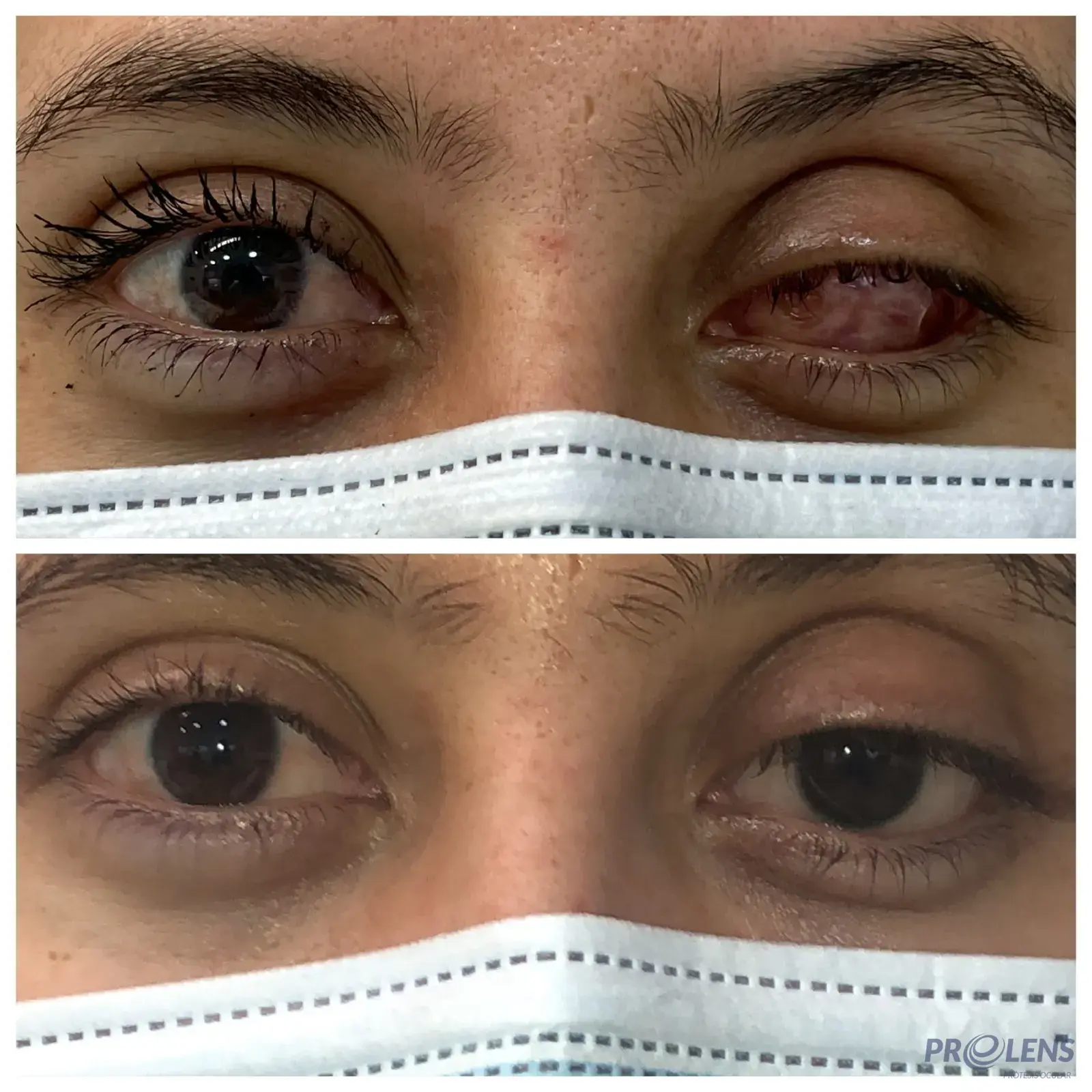 Rehabilitación completa — antes / después